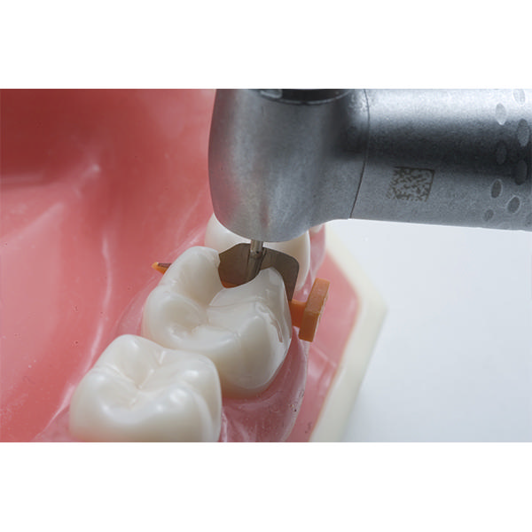 FenderWedge kiler, X-Small, Lilla, 36 stk.