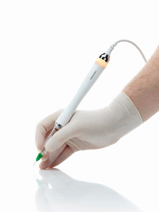 SleeperOne 5. Computerstyret injektionssystem